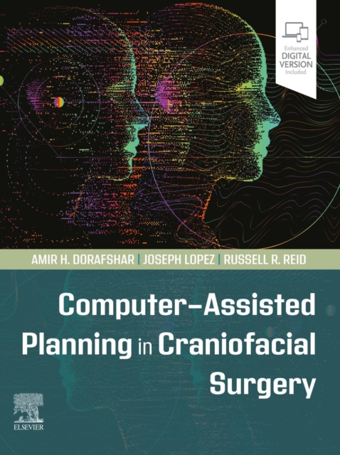 Computer-Assisted Planning in Craniofacial Surgery, EPUB eBook