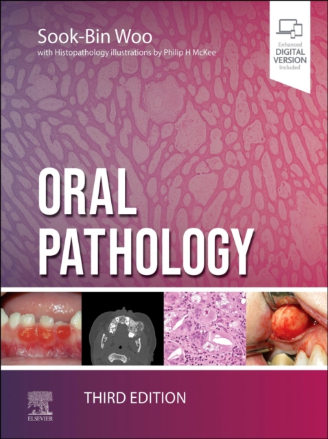Oral Pathology - E-Book, EPUB eBook