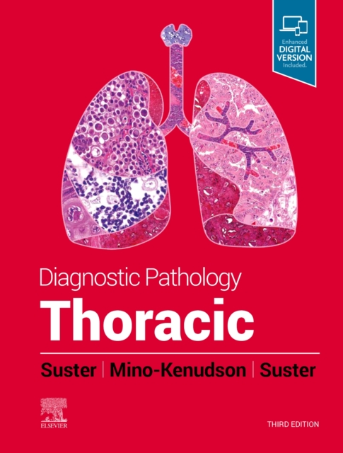 Diagnostic Pathology: Thoracic, Hardback Book
