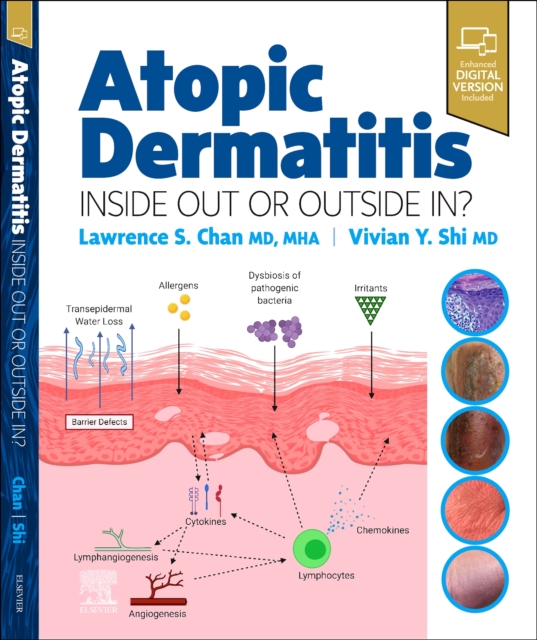 Atopic Dermatitis: Inside Out or Outside In, Hardback Book