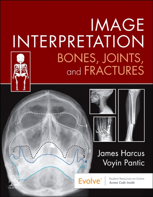 Image Interpretation: Bones, Joints, and Fractures, Paperback / softback Book