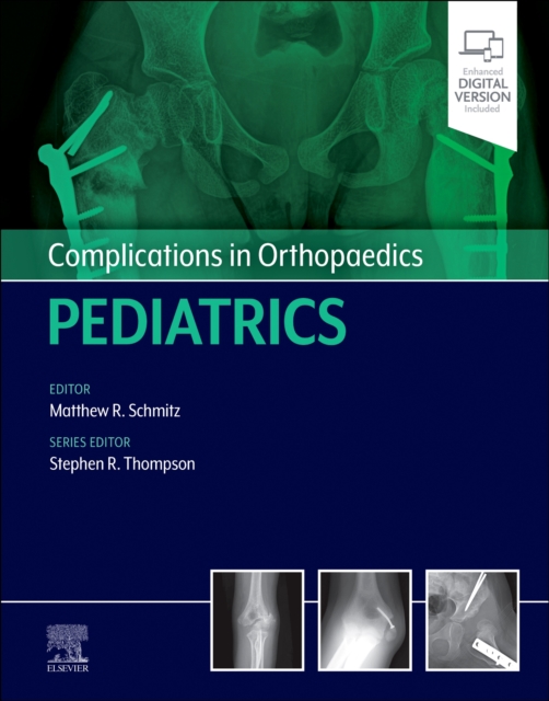Complications in Orthopaedics: Pediatrics, Hardback Book