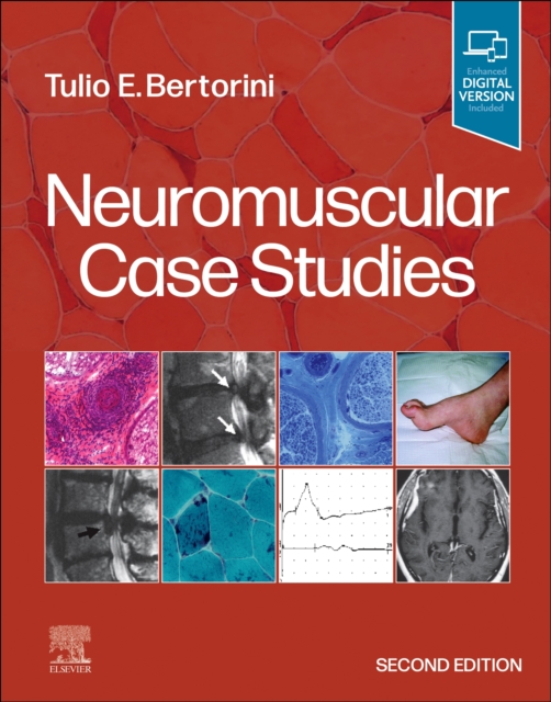 Neuromuscular Case Studies, Paperback / softback Book