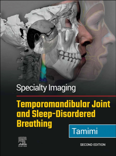 Specialty Imaging: Temporomandibular Joint and Sleep-Disordered Breathing E-Book : Specialty Imaging: Temporomandibular Joint and Sleep-Disordered Breathing E-Book, EPUB eBook