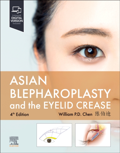 Asian Blepharoplasty and the Eyelid Crease, Hardback Book