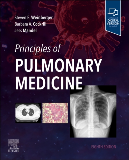 Principles of Pulmonary Medicine, Paperback / softback Book