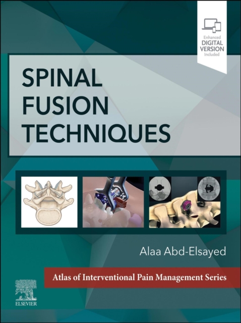 Spinal FusionTechniques, EPUB eBook