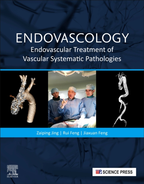 Endovascology : Endovascular Treatment of Vascular Systematic Pathologies, Paperback / softback Book