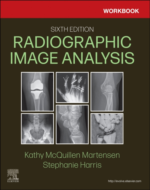 Workbook for Radiographic Image Analysis, Paperback / softback Book
