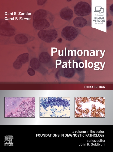 Pulmonary Pathology : Pulmonary Pathology E-Book, EPUB eBook