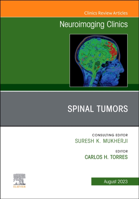 Spinal Tumors, An Issue of Neuroimaging Clinics of North America : Volume 33-3, Hardback Book