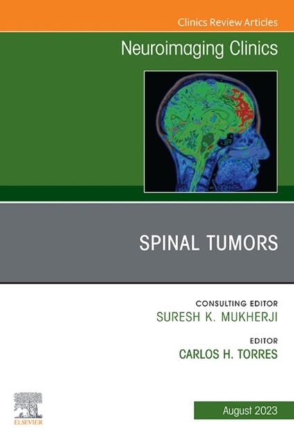 Spinal Tumors, An Issue of Neuroimaging Clinics of North America, E-Book, EPUB eBook
