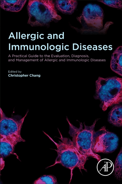 Allergic and Immunologic Diseases : A Practical Guide to the Evaluation, Diagnosis and Management of Allergic and Immunologic Diseases, Mixed media product Book