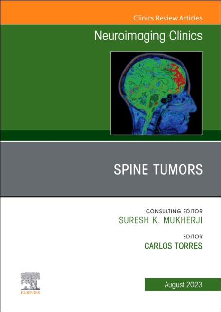 MRI and Traumatic Brain Injury, An Issue of Neuroimaging Clinics of North America : Volume 33-2, Hardback Book
