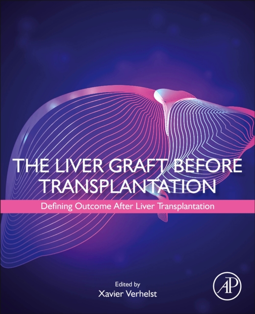 The Liver Graft Before Transplantation : Defining Outcome After Liver Transplantation, Paperback / softback Book