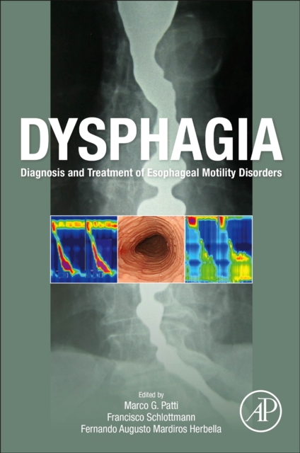 Dysphagia : Diagnosis and Treatment of Esophageal Motility Disorders, Paperback / softback Book