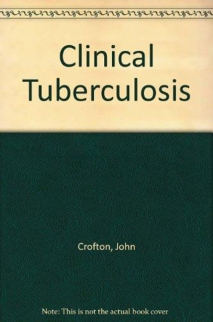 Clinical Tuberculosis Elbs, Paperback / softback Book
