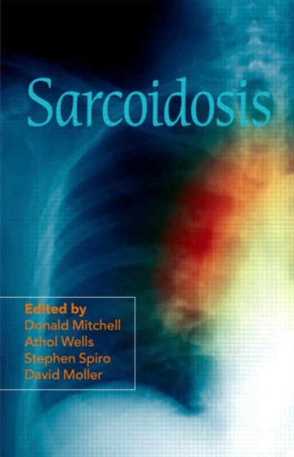 Sarcoidosis, Hardback Book