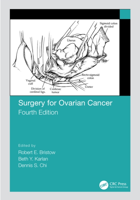 Surgery for Ovarian Cancer, Hardback Book