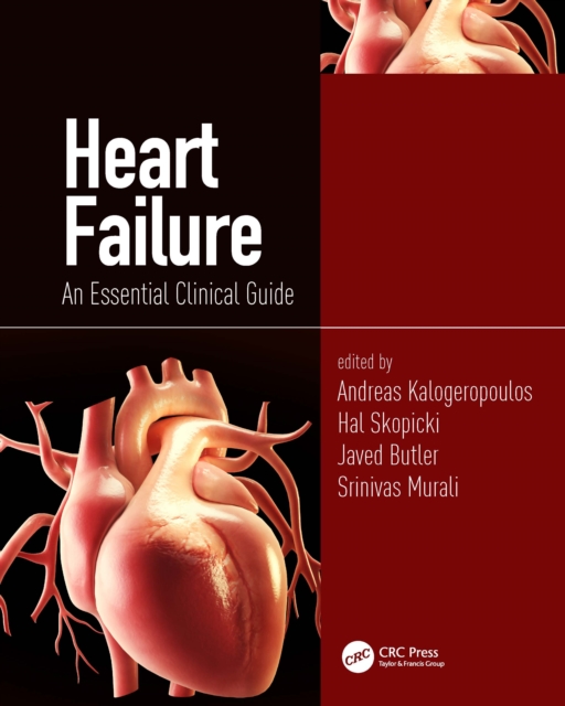 Heart Failure : An Essential Clinical Guide, Hardback Book
