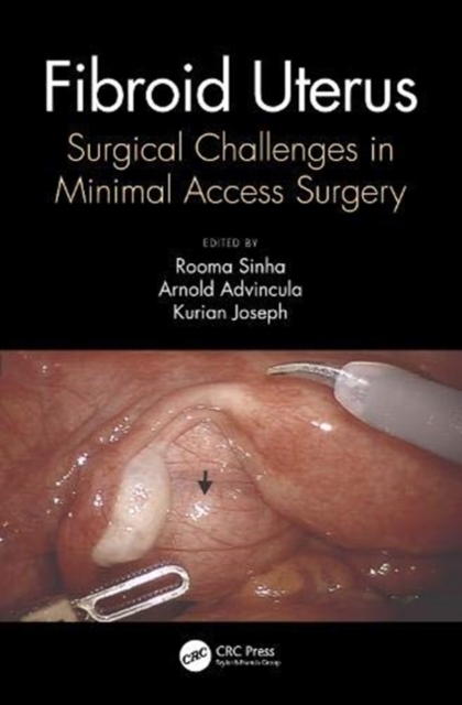 Fibroid Uterus : Surgical Challenges in Minimal Access Surgery, Hardback Book