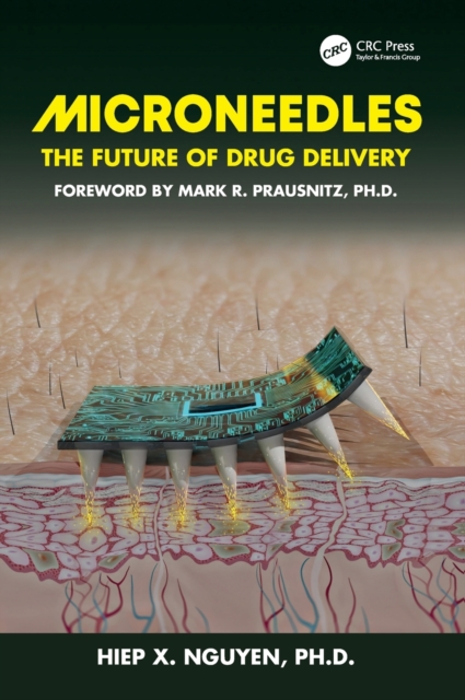 Microneedles : The Future of Drug Delivery, Hardback Book