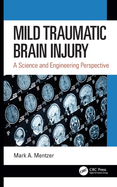 Mild Traumatic Brain Injury : A Science and Engineering Perspective, Hardback Book