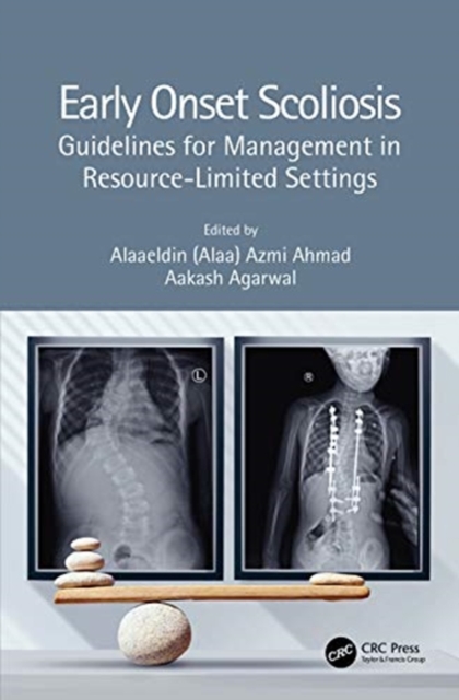 Early Onset Scoliosis : Guidelines for Management in Resource-Limited Settings, Hardback Book