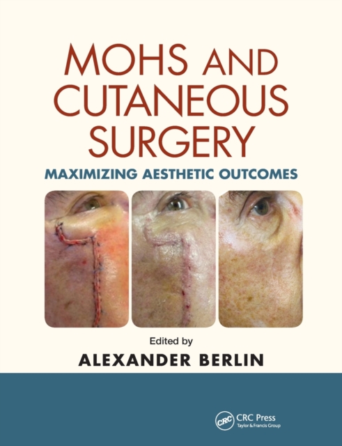 Mohs and Cutaneous Surgery : Maximizing Aesthetic Outcomes, Paperback / softback Book