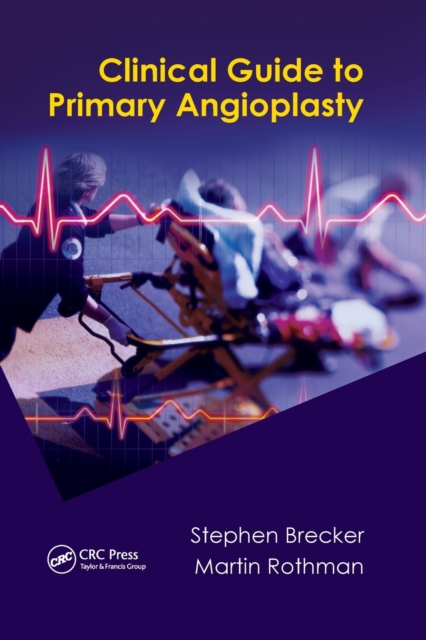 Clinical Guide to Primary Angioplasty, Paperback / softback Book