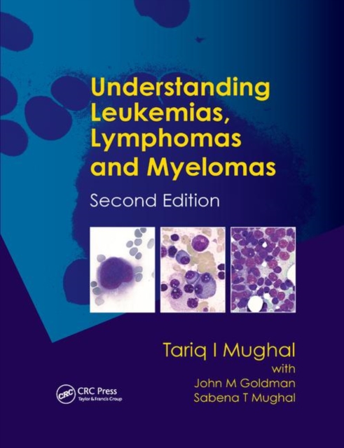 Understanding Leukemias, Lymphomas and Myelomas, Paperback / softback Book