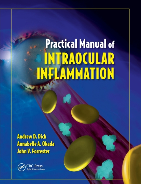 Practical Manual of Intraocular Inflammation, Paperback / softback Book
