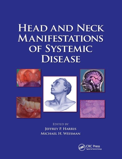 Head and Neck Manifestations of Systemic Disease, Paperback / softback Book