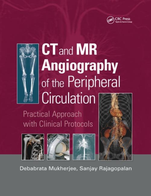 CT and MR Angiography of the Peripheral Circulation : Practical Approach with Clinical Protocols, Paperback / softback Book
