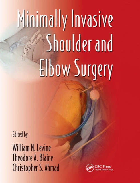 Minimally Invasive Shoulder and Elbow Surgery, Paperback / softback Book