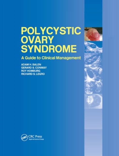 Polycystic Ovary Syndrome : A Guide to Clinical Management, Paperback / softback Book