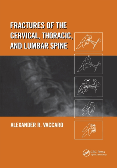 Fractures of the Cervical, Thoracic, and Lumbar Spine, Paperback / softback Book