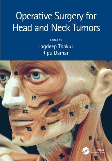 Operative Surgery for Head and Neck Tumors, Hardback Book