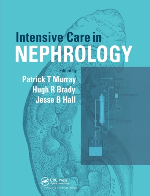 Intensive Care in Nephrology, Paperback / softback Book