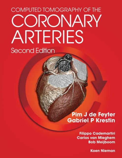 Computed Tomography of the Coronary Arteries, Paperback / softback Book