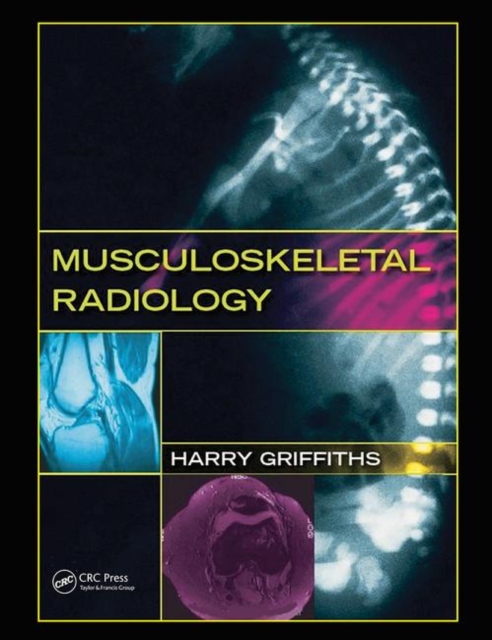 Musculoskeletal Radiology, Paperback / softback Book