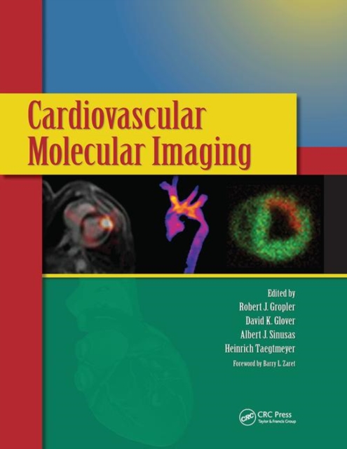 Cardiovascular Molecular Imaging, Paperback / softback Book