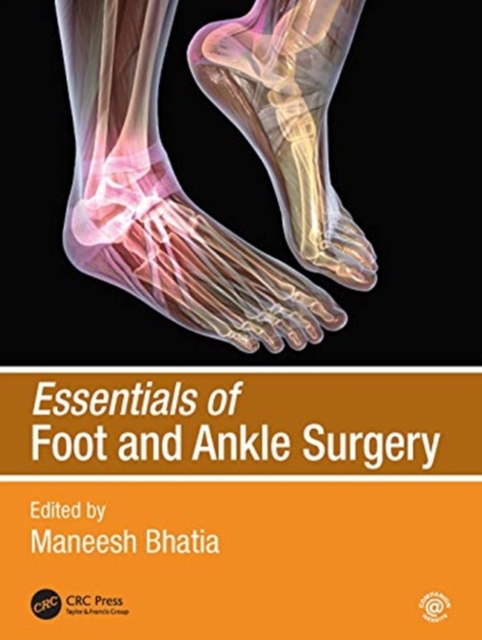 Essentials of Foot and Ankle Surgery, Paperback / softback Book