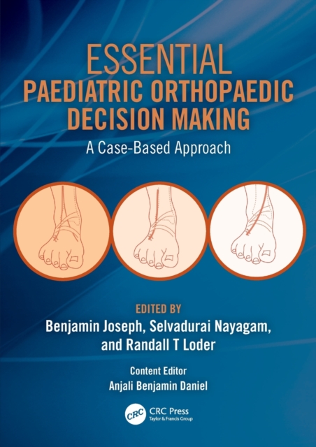Essential Paediatric Orthopaedic Decision Making : A Case-Based Approach, Paperback / softback Book