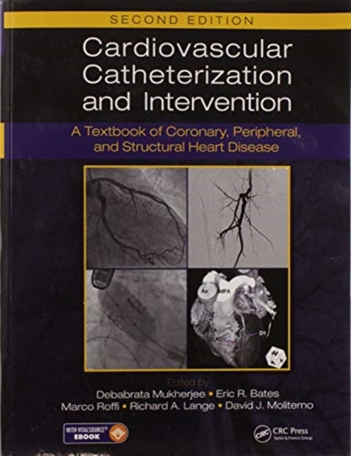 Cardiovascular Catheterization and Intervention : A Textbook of Coronary, Peripheral, and Structural Heart Disease, Second Edition, Paperback / softback Book