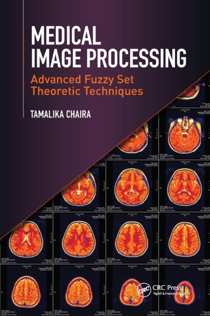 Medical Image Processing : Advanced Fuzzy Set Theoretic Techniques, Paperback / softback Book