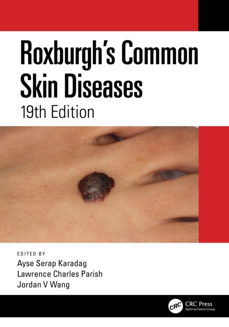 Roxburgh's Common Skin Diseases, Paperback / softback Book