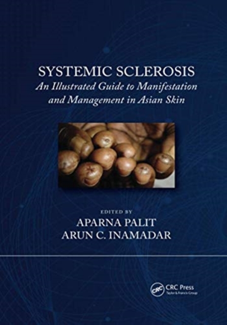Systemic Sclerosis : An Illustrated Guide to Manifestation and Management in Asian Skin, Paperback / softback Book