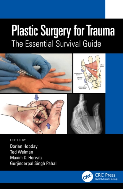 Plastic Surgery for Trauma : The Essential Survival Guide, Hardback Book