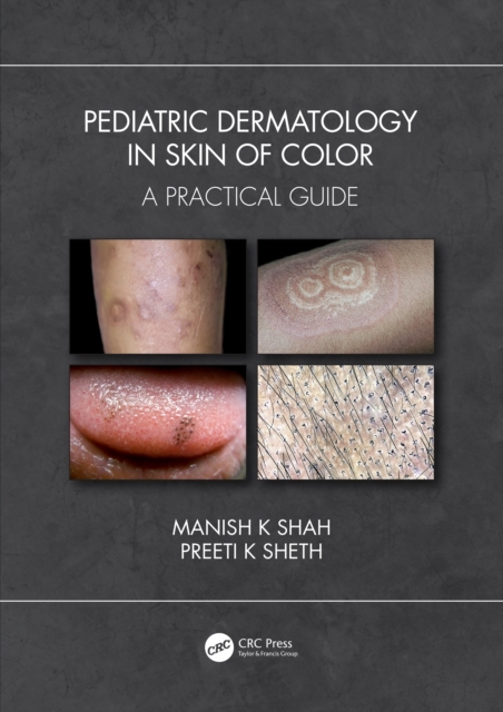 Pediatric Dermatology in Skin of Color : A Practical Guide, Paperback / softback Book